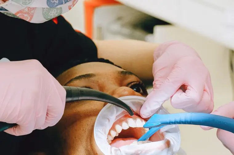 Profissional realizando limpeza dental com afastador bucal